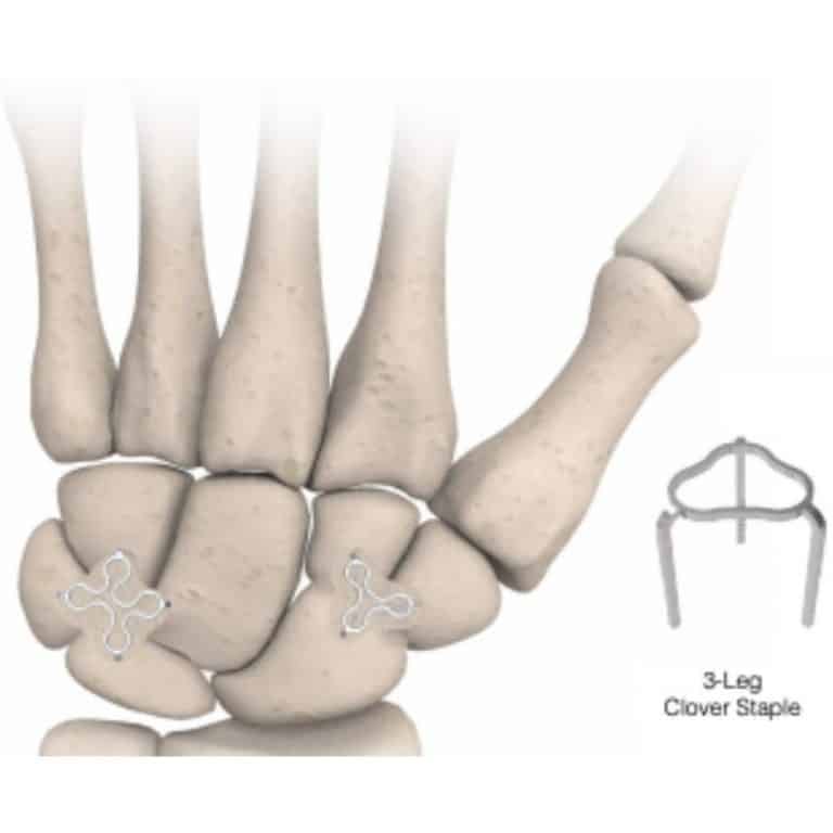 Clover Staples MedQuest Medical Inc.